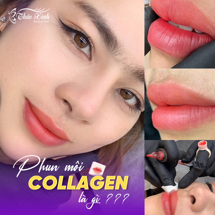 Phun Môi Collagen Là Gì? Bí Quyết Cho Đôi Môi Tươi Tắn, Hồng Hào Tự Nhiên 1