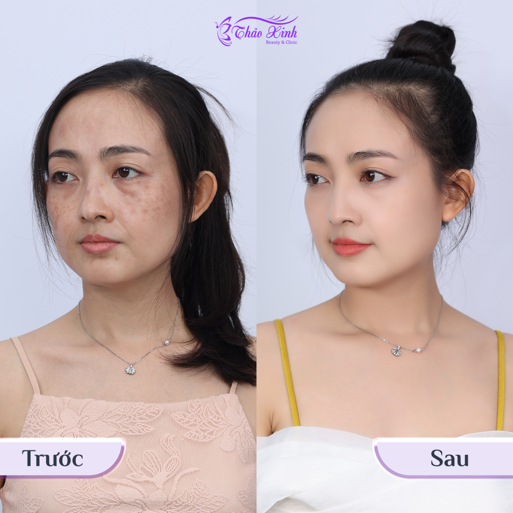 Phòng Khám Thảo Xinh Có Tốt Không 13