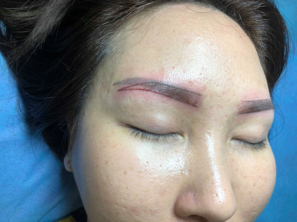 Xóa Chân Mày Hai Đuôi 28