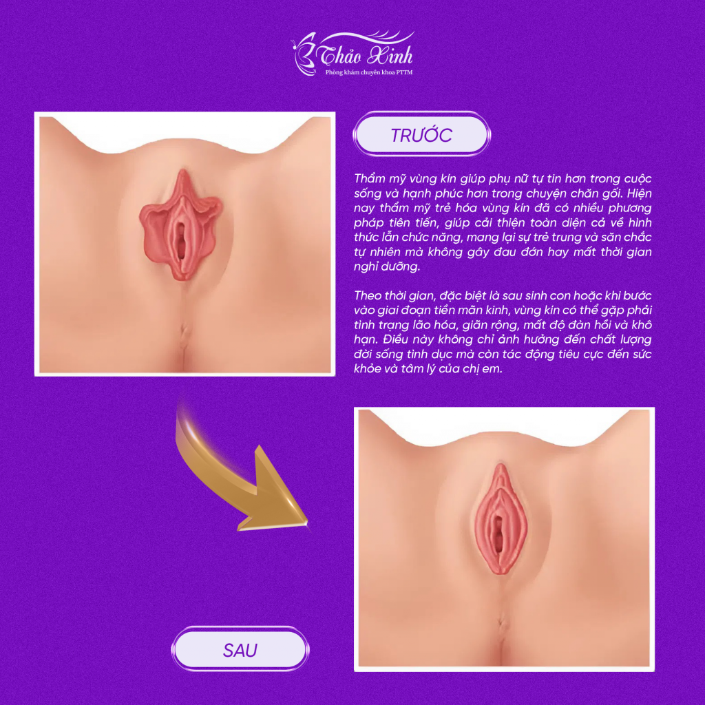 Thu Nhỏ Môi Bé Vùng Kín 8
