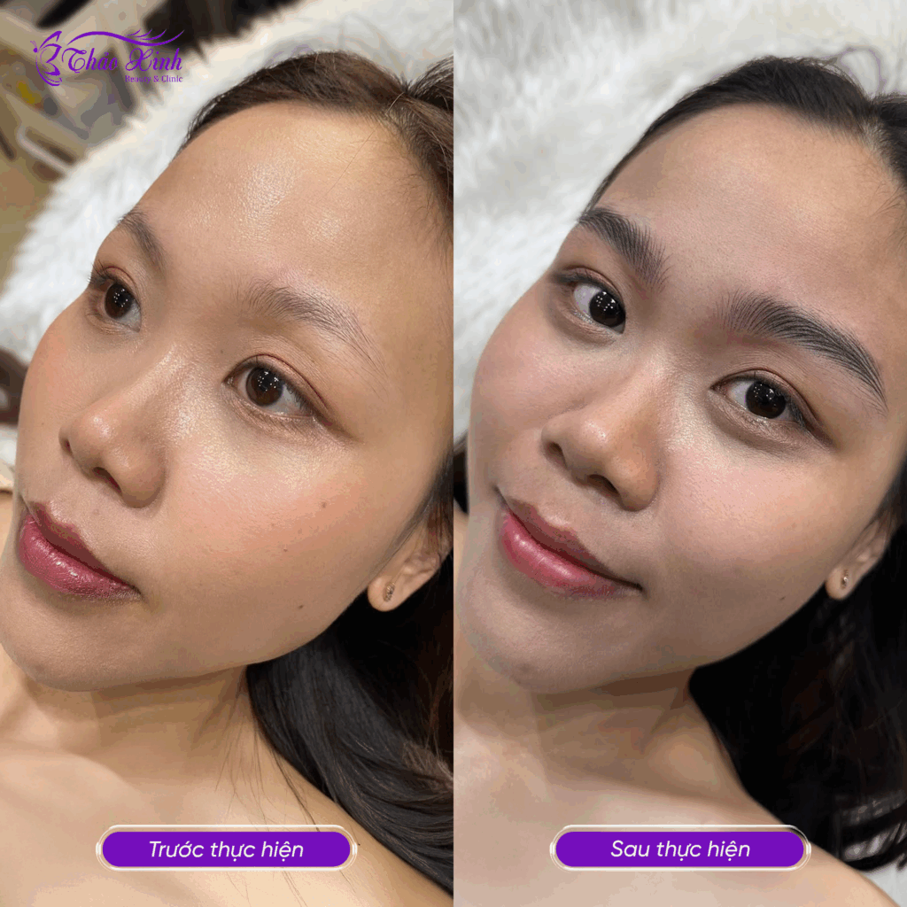 Phun Xăm Thẩm Mỹ 6