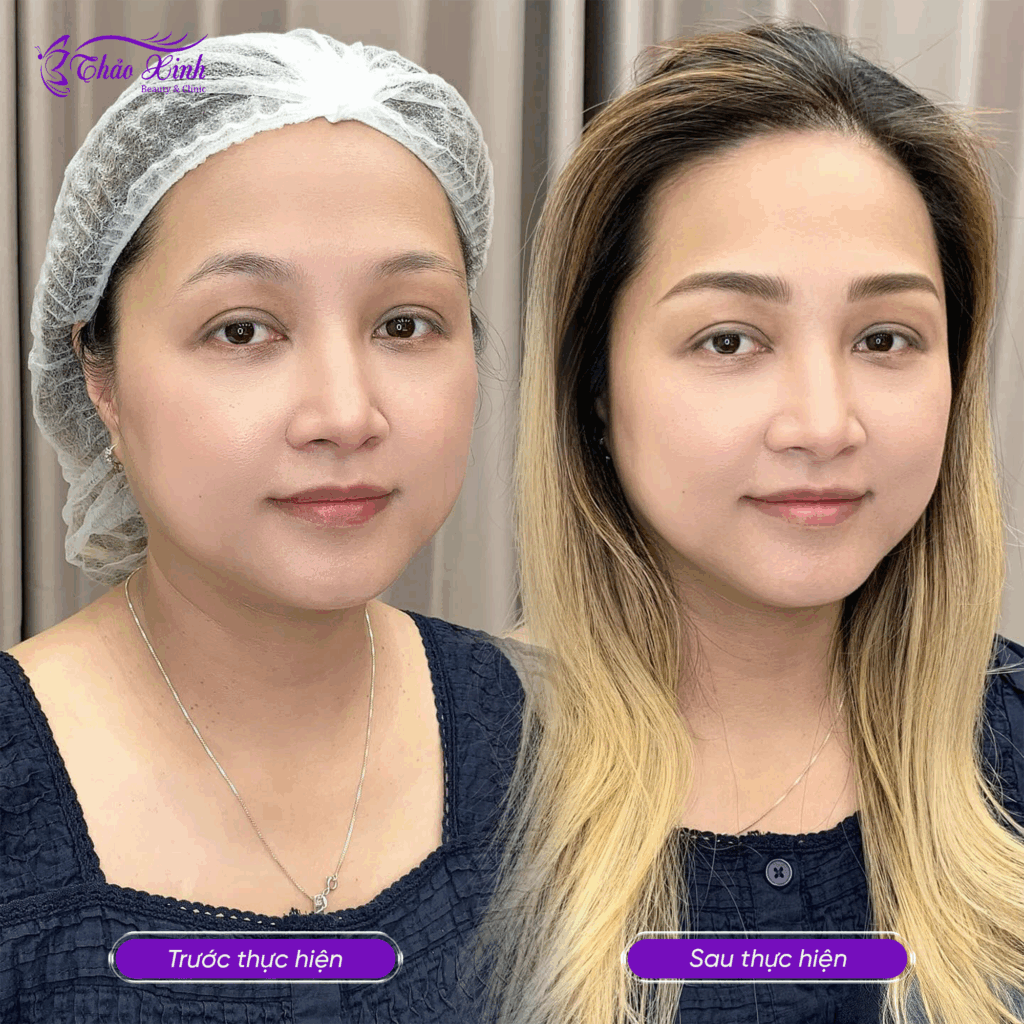 Phun Xăm Thẩm Mỹ 5