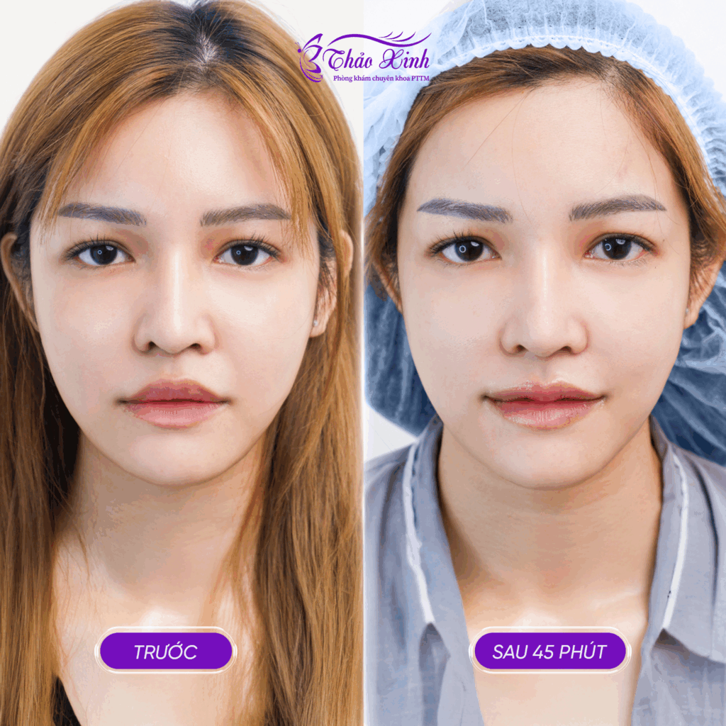 Tạo Hình Môi Trái Tim 4