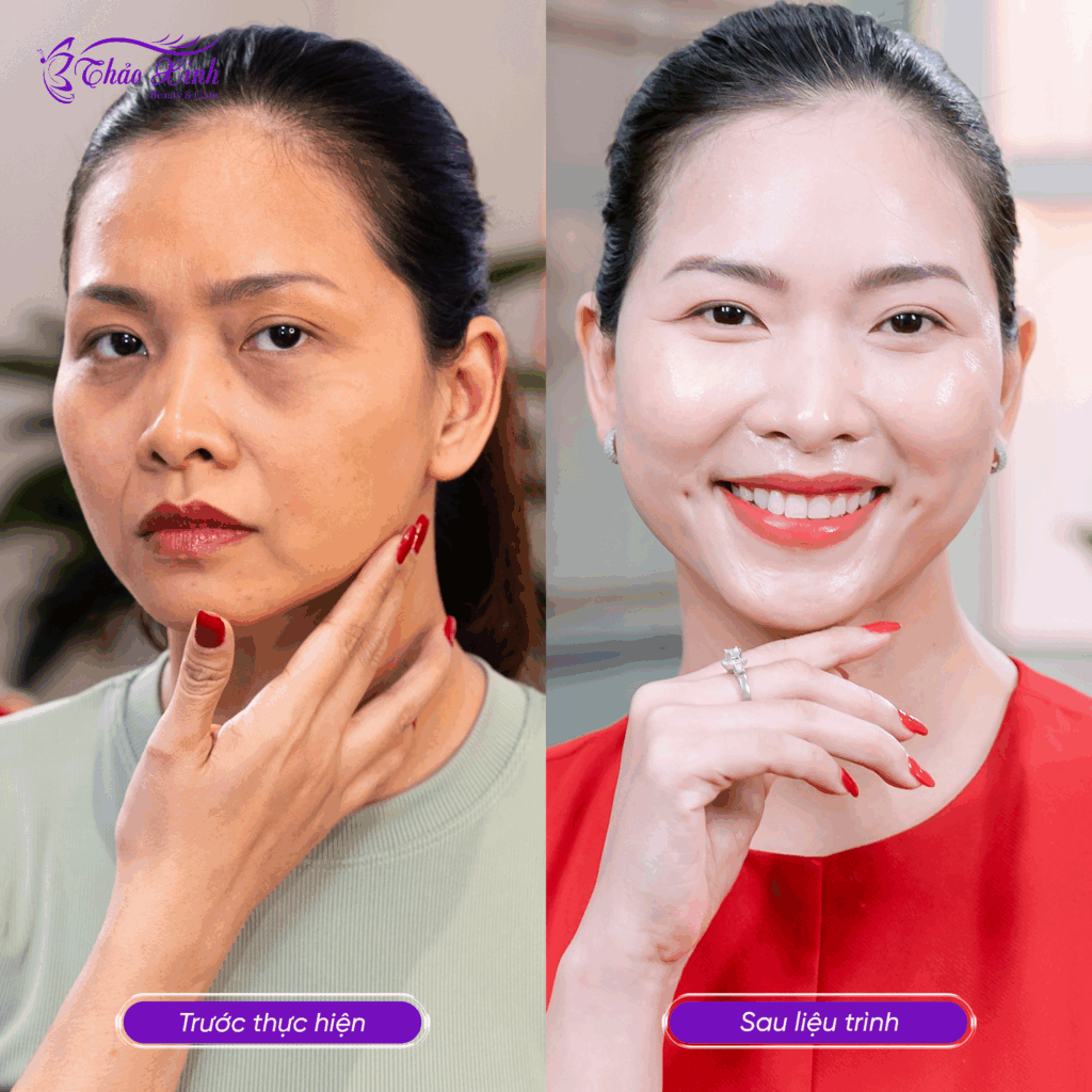 Chăm Sóc Da Chuyên Sâu 5