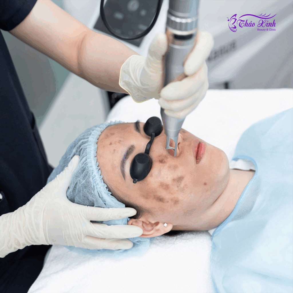 Điều Trị Da Công Nghệ Cao 4