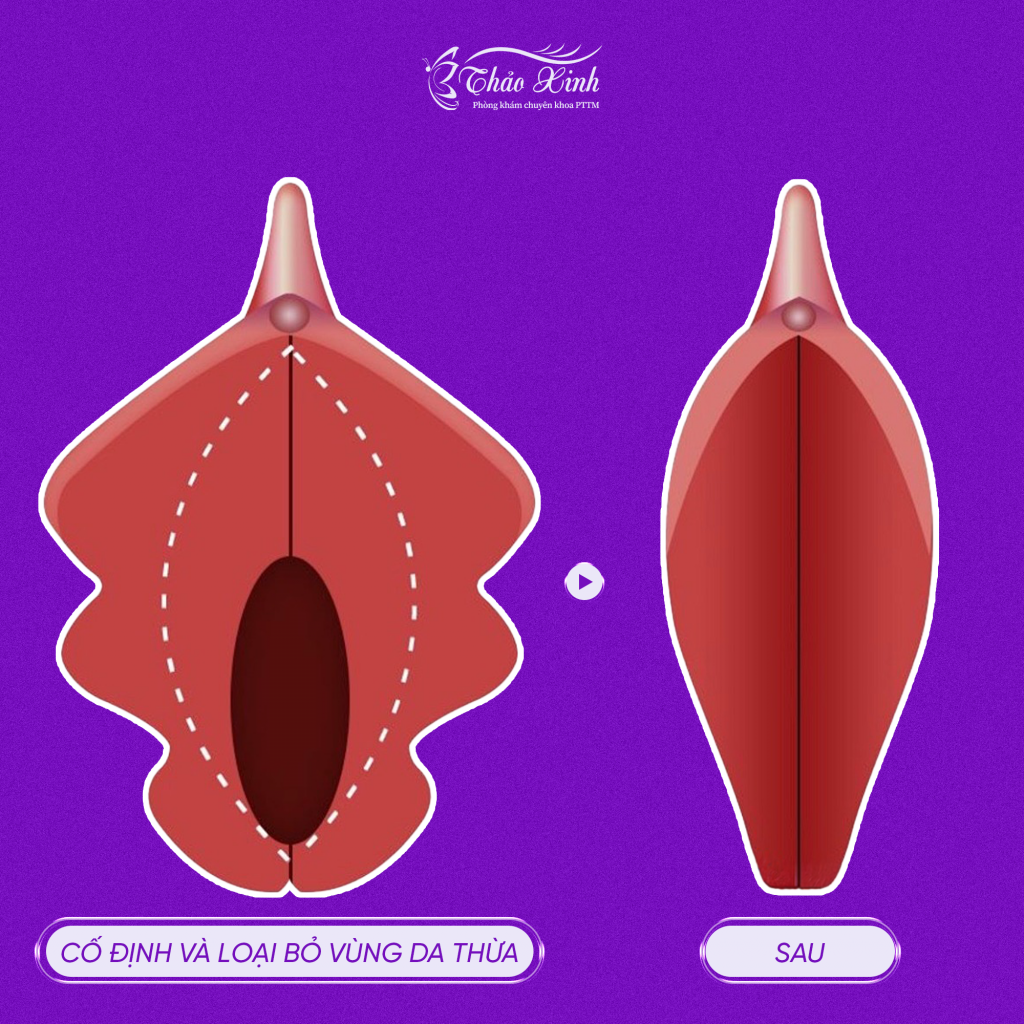 Thu Nhỏ Môi Bé Vùng Kín 6